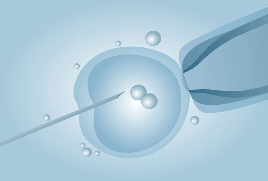 Ilustração de uma fertilização in vitro, na inseminação articicial